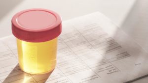 Urinalysis in Dogs